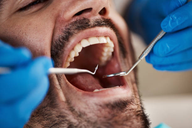 Dental X-Rays and Imaging in Kettering, OH