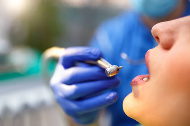 Best Wisdom Tooth Removal  in Kettering, OH